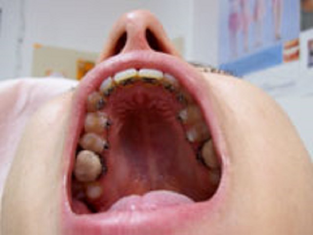 ортодонт