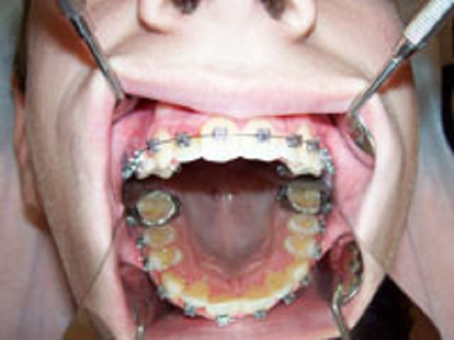 ортодонт